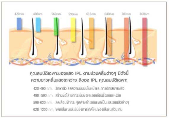 รีวิว IPL ipl ดีจริงไหม ทํา ipl ดีไหม ipl ช่วยอะไร ทํา ipl กี่ครั้งเห็นผล ประสบการณ์ ipl ทำ ipl ราคา