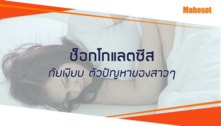 โรคช็อกโกแลตซีสต์ คืออะไร วิธีการรักษา สาเหตุ