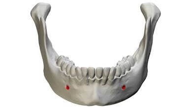 ฟิลเลอร์คาง-mental-foramen-1