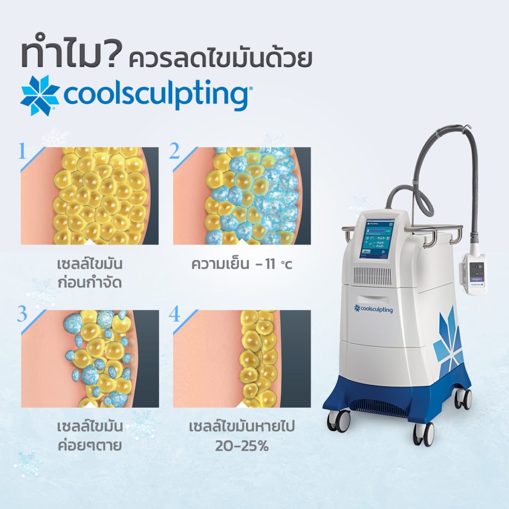 Coolsculpting ราคา – ทำไมควรลดไขมันด้วยความเย็น