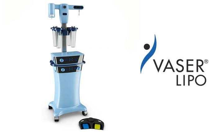 Vaser : Ultrasound Assisted Liposuction คลื่นเสียง Ultrasonic