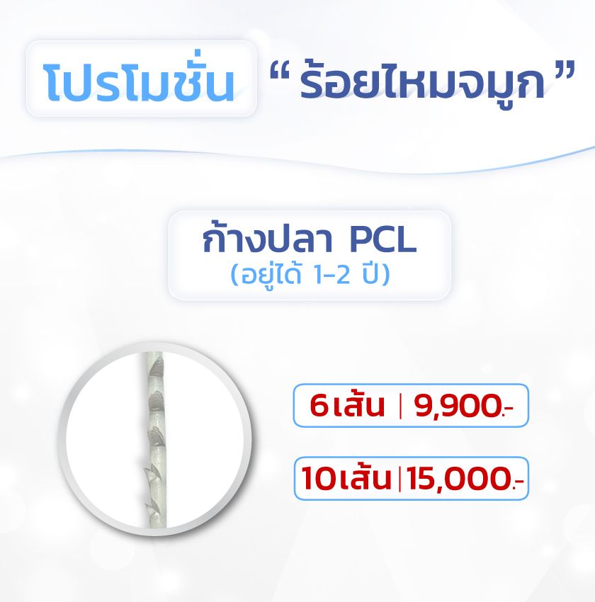 ร้อยไหมจมูก-ราคา-promotion