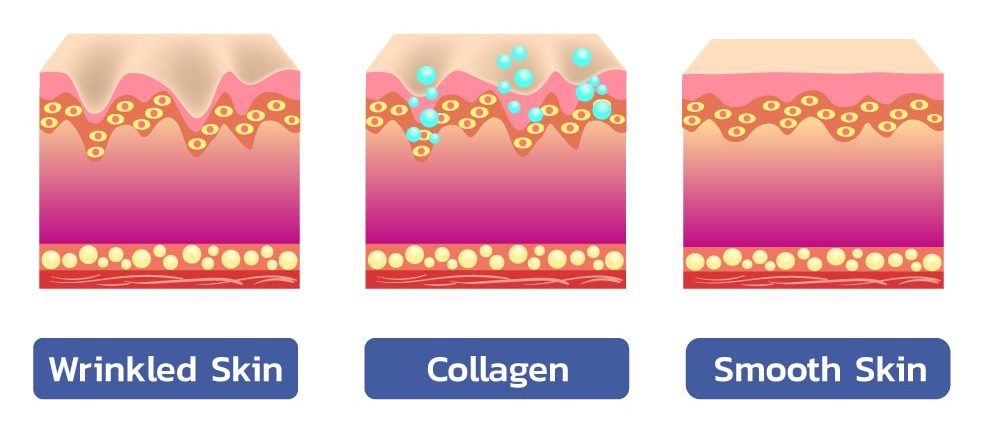 3 สูตรเมโสหน้าใส มาเด้คอลลาเจน